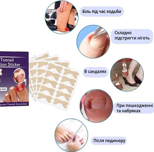Elastic Toenail Correction Sticker фото 2