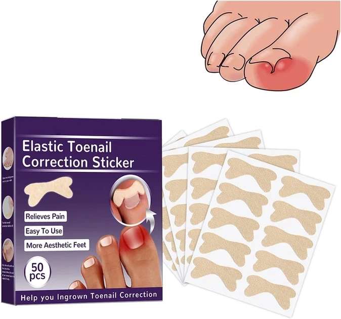Набір Elastic Toenail Correction Sticker 50 штук